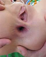HD-pix - anal, Ã¢nus, buceta gorda, retalhos, gape, buceta