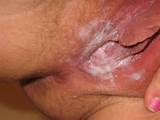 MINHA buceta descarga - mydischargepic@gmail.com â€¢ sujo fedorento fedorento...