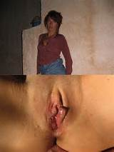 Buceta costurada - casa Jpg Porn