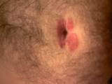 Minha vagina estÃ¡ coÃ§ando 169582 | imagem de usuÃ¡rio