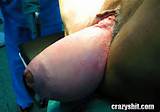 Sua Vagina Ã© uma verruga - Crazyshit.com