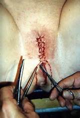SM-BDSM-torture-Tortured-Cunt-Pussy-vagina-Pain-punished-Tortured...