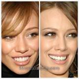 Cirurgia plÃ¡stica de Hilary Duff-dental Odontologia do trabalho/cosmÃ©ticos