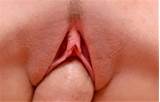 Meninas Camel Toe