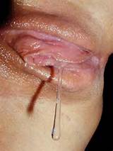 PrettyPussyAlert #PussyPics - #Wet #Pussy suculento a pingar