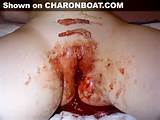 ... Mutilation