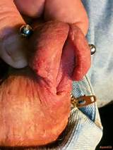 porn613 mutilaÃ§Ã£o de penile - Galeria de imagens de adultos-