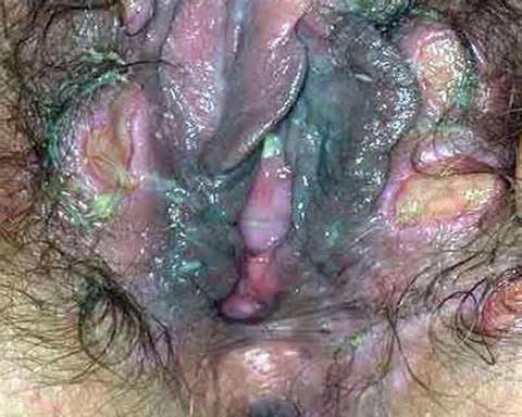 waffle azul