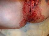 Mulher sangrando buceta - perÃ­odo 15 de 23 fotos