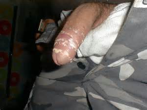 NÃ£o estÃ¡ doente suficiente? Confira: [trocar filhotes] [entediado Dykes] [Grubby...